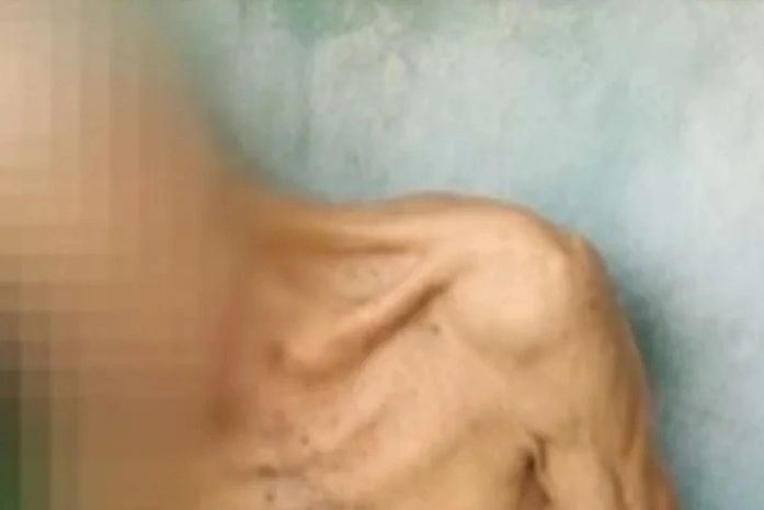 Filho é preso após idoso de 80 anos ser resgatado em situação de maus-tratos e cárcere em AL