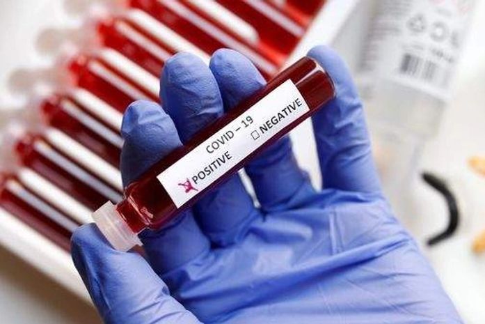 Covid-19: Alagoas registra mais cinco mortes e número total de óbitos chega a 2.162