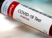 Alagoas confirma três mortes e 58 novos casos de Covid-19 nesta segunda (18)