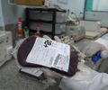 Banco de Sangue: Santa Casa de Maceió tem estoque crítico e alerta para risco de suspensão de procedimentos