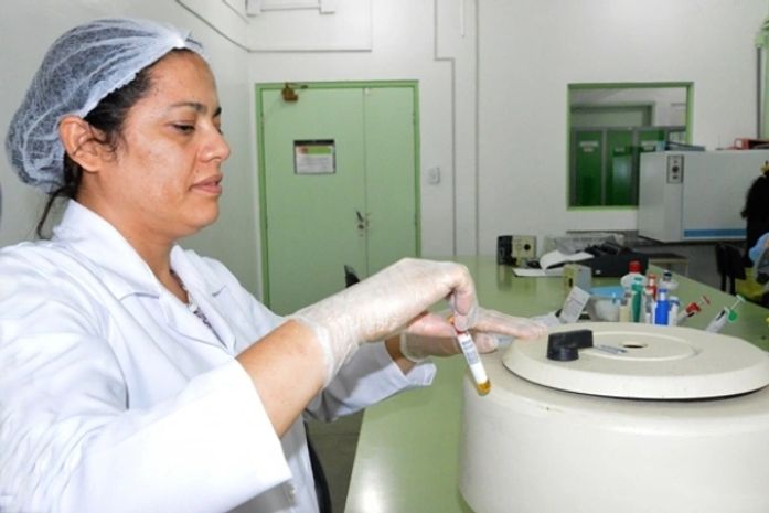 Teste rápido de zika irá assegurar a realização do exame em tempo oportuno
