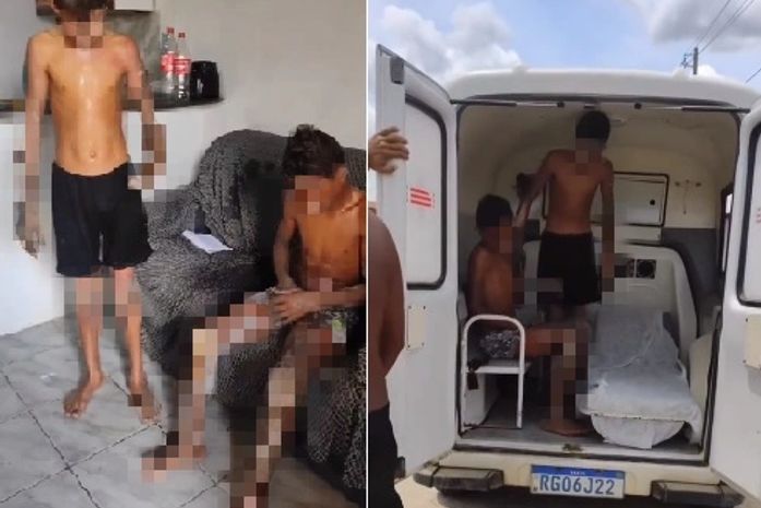 Adolescente sofreram queimaduras graves após explosão de fogos de artifício
