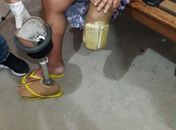Visitante do presídio é presa com celulares e drogas escondidos na prótese da perna