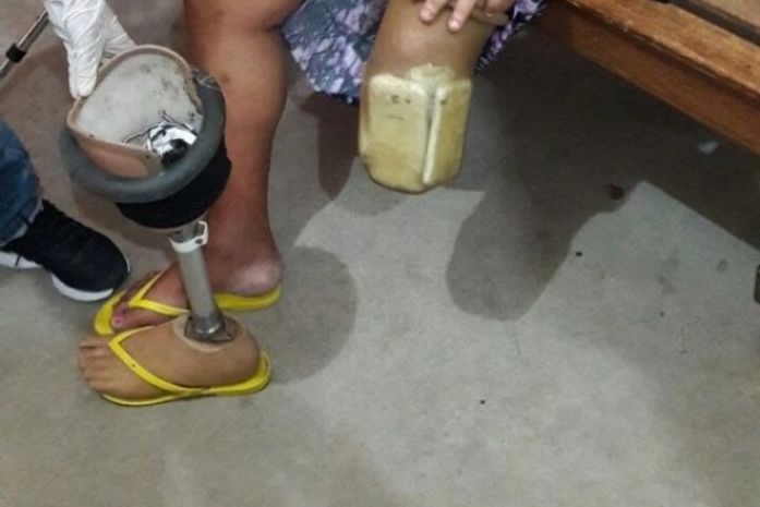 Visitante do presídio é presa com celulares e drogas escondidos na prótese da perna
