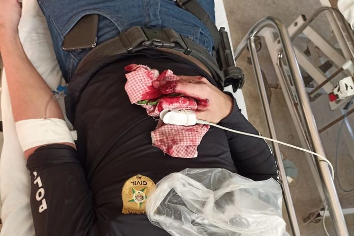 Policial baleado