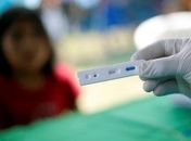 Países pobres terão 120 milhões de exames de covid-19 a US$ 5