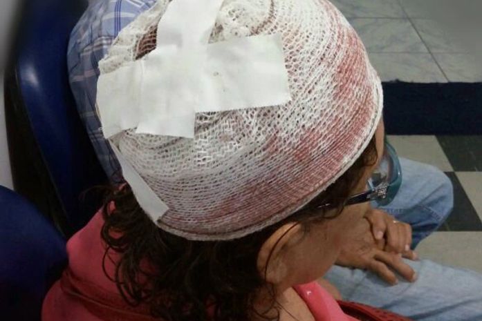 Vítimas de atropelamento