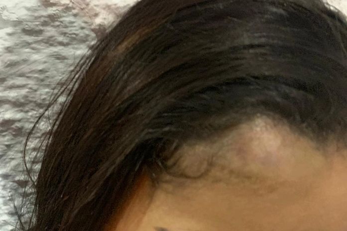 Mulher diz que foi agredida a marteladas por supostos PM