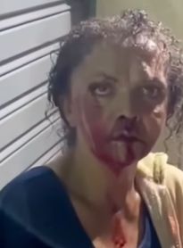 Mulher é agredida em via pública em Quebrangulo