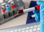 Você sabia que muitos exames de sangue não precisam de jejum para serem realizados?