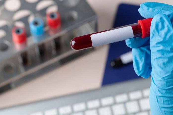 Você sabia que muitos exames de sangue não precisam de jejum para serem realizados?