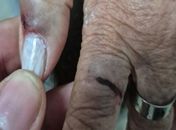 MP de Alagoas denuncia médica por agressão e lesão contra tia idosa de 77 anos no Agreste