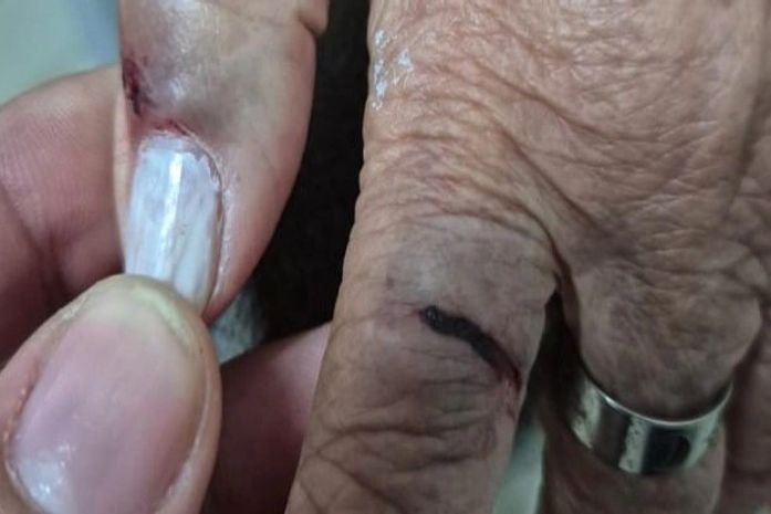 MP de Alagoas denuncia médica por agressão e lesão contra tia idosa de 77 anos no Agreste