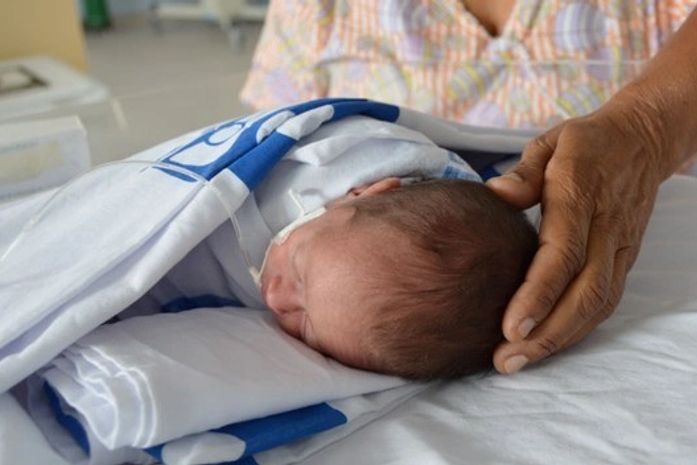 Sobem casos de microcefalia em Alagoas