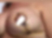 Mais de 20 mulheres denunciam suposto erro médico em cirurgias plásticas, em Maceió