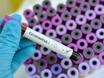 Rs=w:350,h:263,i:true,cg:true,ft:cover?cache=true
