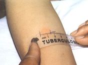SMS realiza dois tipos de exames para diagnóstico de tuberculose