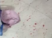 Estudante baleado em escola não corre risco de morte, diz Sesau