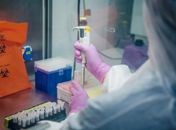 Com baixo estoque, Alagoas recebe mais 3 mil testes de RT-PCR para diagnóstico da Covid-19