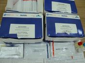 Teste Rápido de Zika passa a ser obrigatório para gestantes durante pré-natal em Alagoas