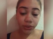 Mulher denuncia agressão dentro de van durante ida a show em AL: “não tinha ninguém para me ajudar”