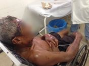 Bandidos invadem residência e agridem idoso de 78 anos em Marechal Deodoro