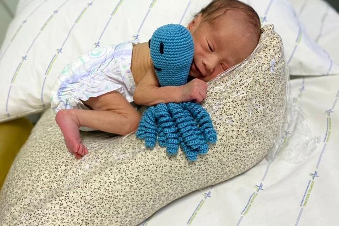 Polvinhos de crochê melhoram a recuperação em bebês prematuros do Hospital Regional
