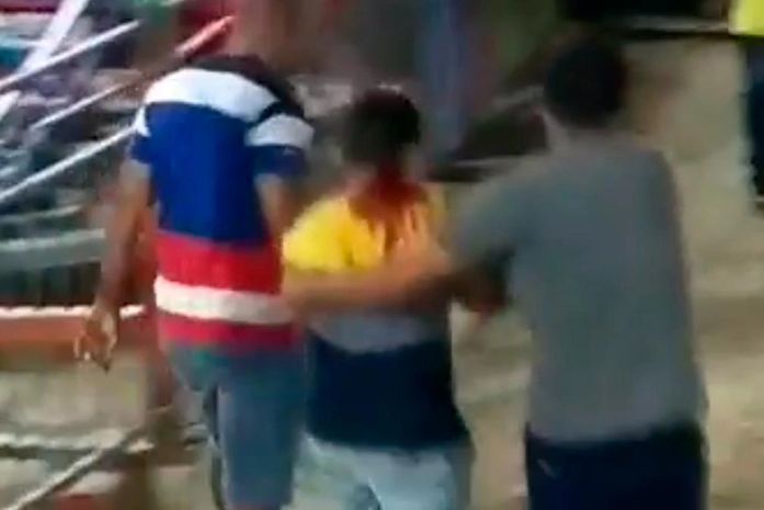 Donos de parque de diversões terão que prestar esclarecimentos à Defensoria sobre acidente com criança