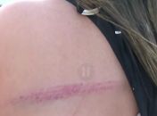 Moradores de Rio Largo denunciam agressão da PRF em ato contra falta de água