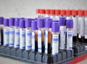 Hemoal intensifica ações itinerantes para aumentar cadastros para doação de medula óssea