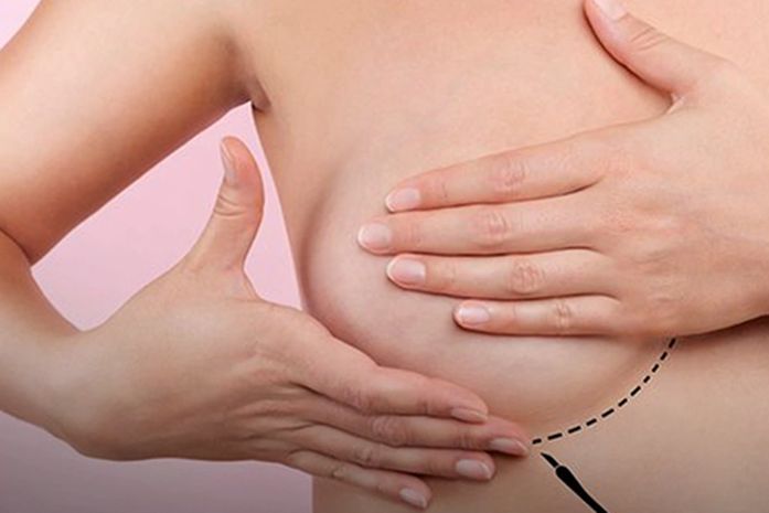 Tratamento pode fazer câncer de mama regredir seis vezes mais rápido