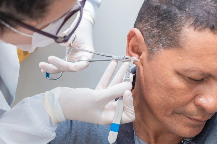 Laboratório de Análises Clínicas de Maceió realiza baciloscopia para identificação de hanseníase