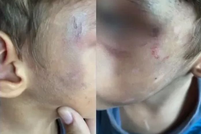 Criança de 4 anos era agredido com socos, chineladas e apanhava com fio.