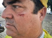 Homem é preso após dar soco no rosto de comandante do Ronda no Bairro