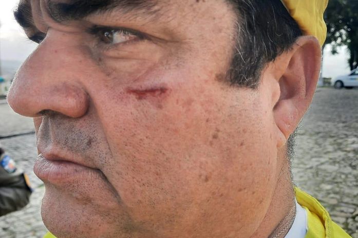 Homem é preso após dar soco no rosto de comandante do Ronda no Bairro