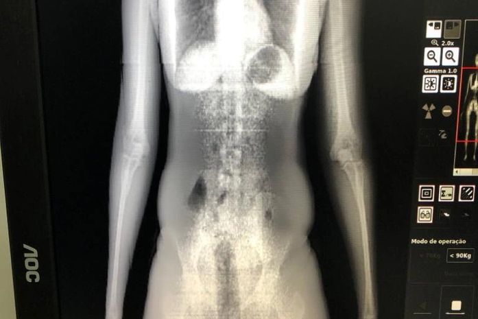 Mulher é presa ao tentar entrar em presídio com droga escondida no ânus