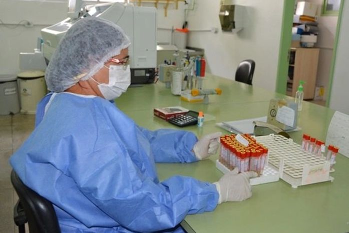 Laboratório vai capacitar profissionais para o diagnóstico do Zika vírus