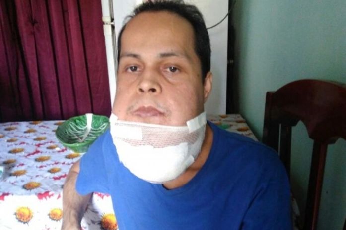 Família de jovem com malformação arteriovenosa busca ajuda para tratamento