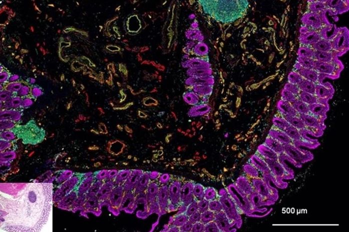 Homem tosse e espirra ao mesmo tempo e intestino escapa por cicatriz
