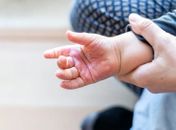 Férias e calor elevam riscos: em 2025, Alagoas registra 84 internações por queimaduras em crianças pequenas; maioria dos casos envolve líquidos quentes, alerta especialista