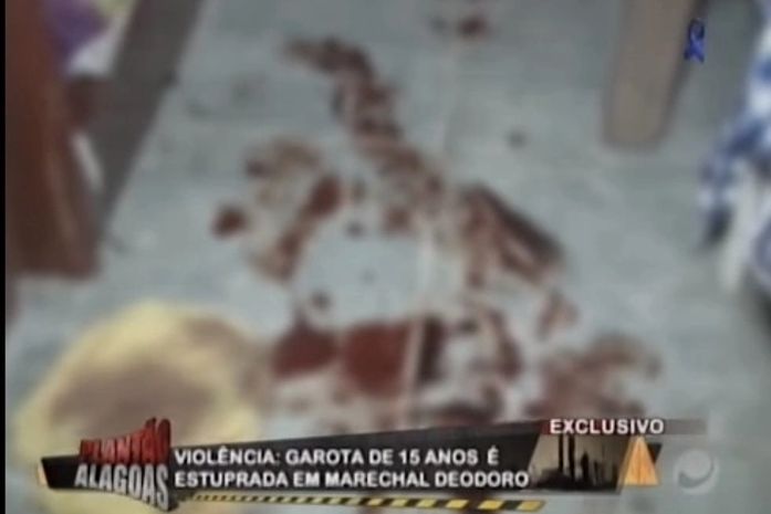 Durante estupro, acusado introduz líquido na vagina de menor que provoca grave hemorragia