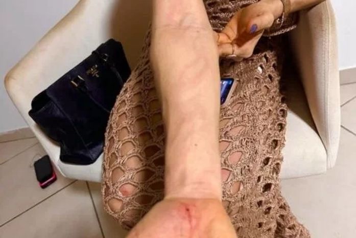 Governo de AL afasta piloto aviador da Polícia Civil suspeito de agredir mulher em condomínio de Maceió