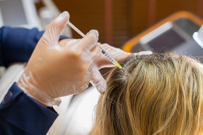 Problemas capilares? Conheça procedimentos estéticos que podem te auxiliar!