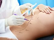 Cirurgião plástico alagoano alerta para os riscos de procedimentos não recomendados