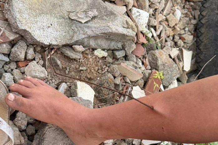 Menino de 10 anos é resgatado pelos bombeiros após ter perna perfurada por vergalhão