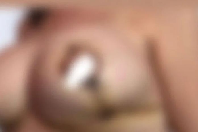 Mulheres denunciam cirurgião por erro médico