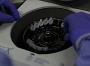 Aumento aconteceu cerca de 24 horas depois de confirmação de 1º caso