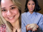 Mudanças de humor frequentes e medo do abandono: entenda o que é transtorno borderline