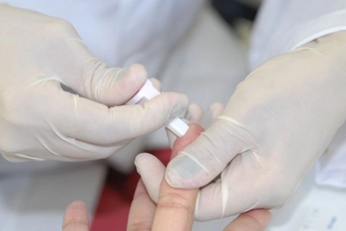 Além da polpa digital, existe também o teste de fluido oral para triagem do HIV