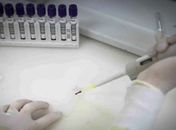 Paciente em SP com suspeita de ebola testa positivo para meningite